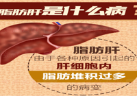【健康科普】武宁县人民医院感染科：远离脂肪肝，健康好生活