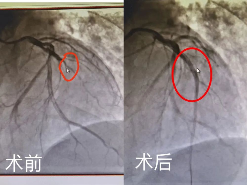 https://mmbiz.qpic.cn/mmbiz_jpg/OMoZ71ahOUBLhkDic2VnBAGJkofyNdB6UBQxicXVSeA3HHcZbaaV77MLVtD74vf9f0Tkibicxbpts9lCGaIWRPt4Ng/640?wx_fmt=jpeg&wxfrom=5&wx_lazy=1&wx_co=1