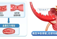 【世界肾脏日】武宁县总医院人民医院院区肾内风湿内分泌科：您的肾脏健康吗？早检查，保健康