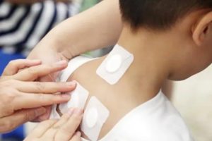 【中医技术】春季鼻炎发作—中医适宜技术让鼻子畅快呼吸