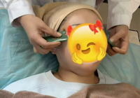 【中医特色疗法】“刮”出好气色！面部全息玉石刮痧—让您不动刀也能悄悄变美！