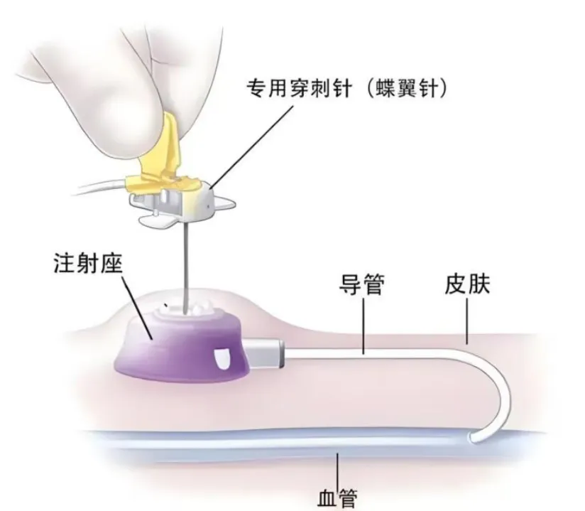 6c874657fd9347bdb24b9d3f3d35f722.png